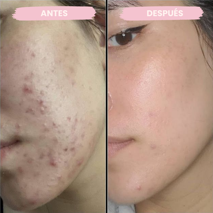 Serum Anti-Manchas con Centella Asiática (100ml)