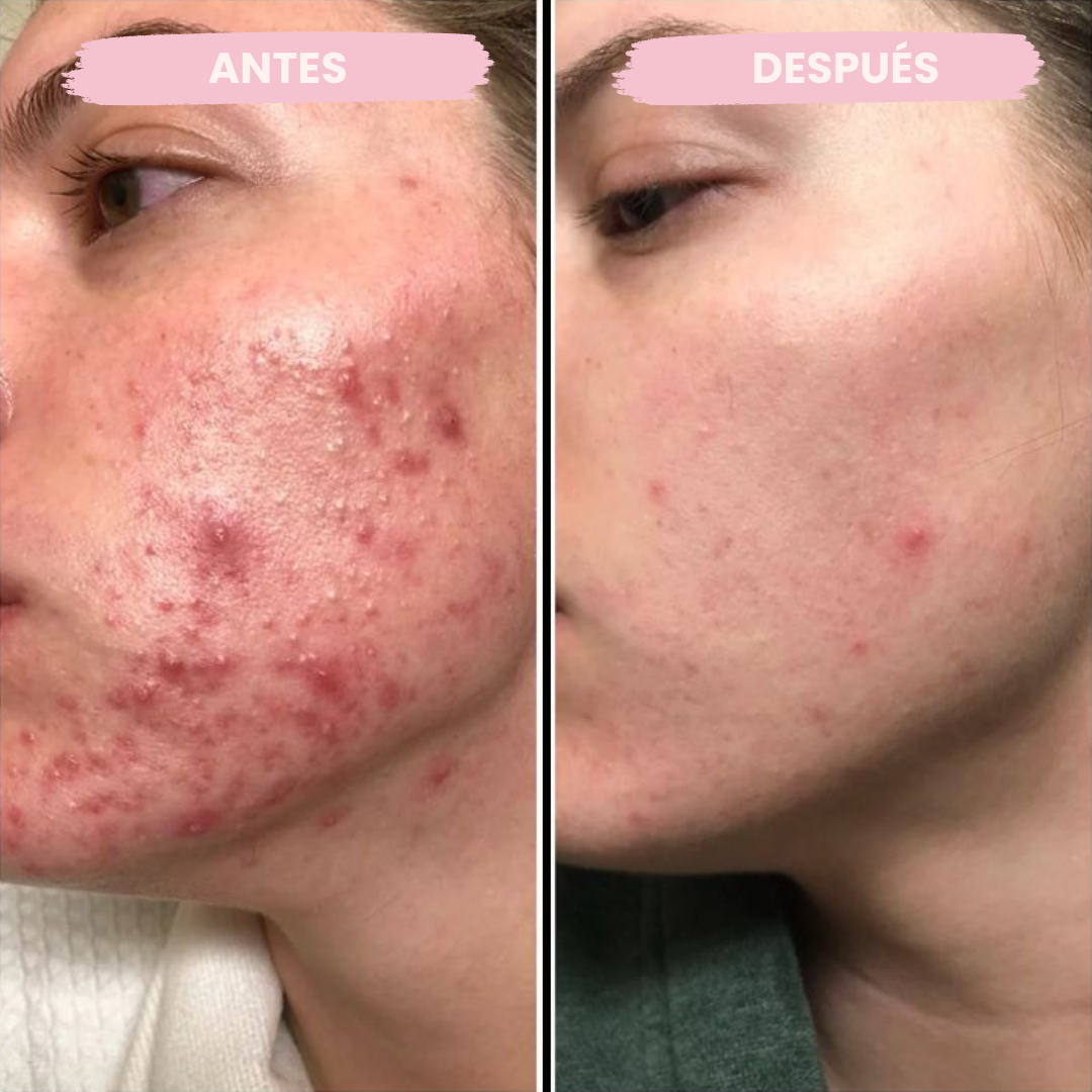 Serum Anti-Manchas con Centella Asiática (100ml)