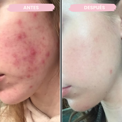 Serum Anti-Manchas con Centella Asiática (100ml)