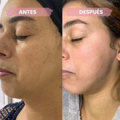 Serum Anti-Manchas con Centella Asiática (100ml)